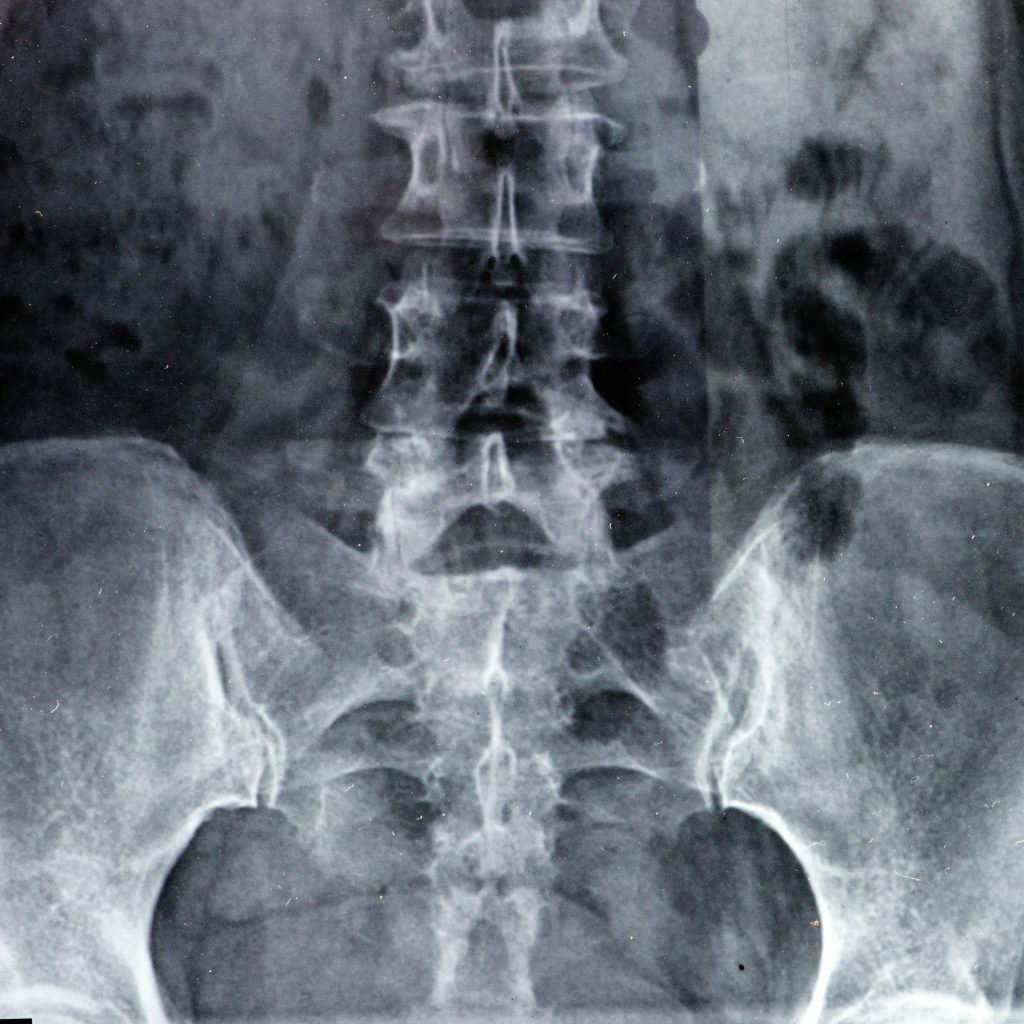 Zánětlivá onemocnění se zjišťují laboratorními testy.