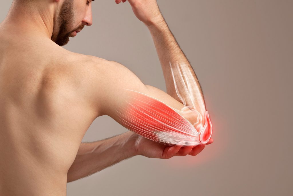 Golfer's Elbow